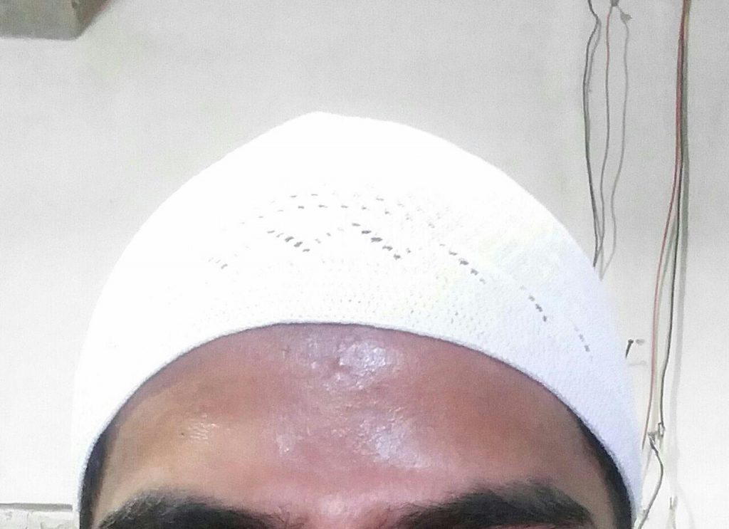 Peci Knitting Turkiy 4