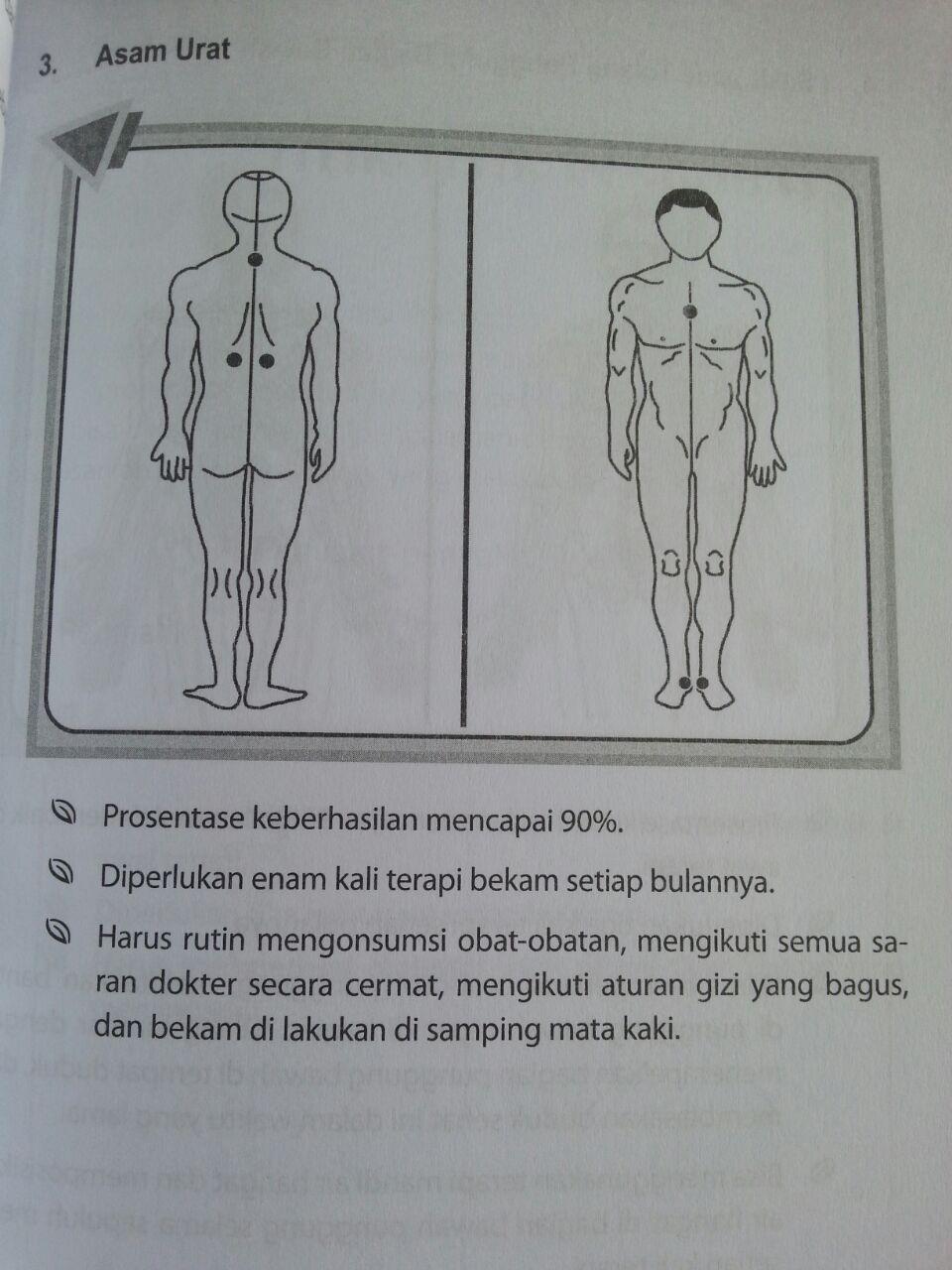 Buku Panduan Bekam Bergambar Seni Bekam Syar'i Untuk Penyakit isi 3